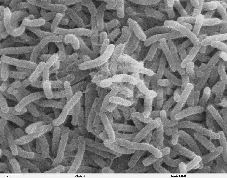 Bactérie Vibrio cholerae dans l'intestin d'un malade du choléra. Notre tube digestif recèle nombre de bactéries inoffensives